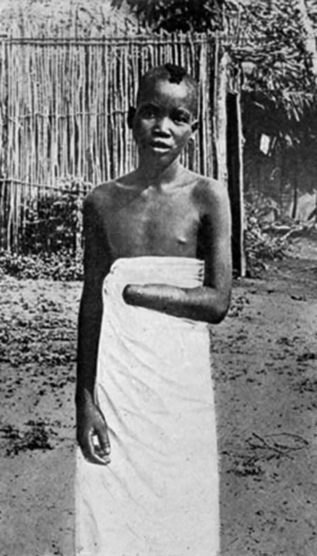 The Belgian Congo's Hacked Hands: A Brutal Reminder of Colonial Atrocities