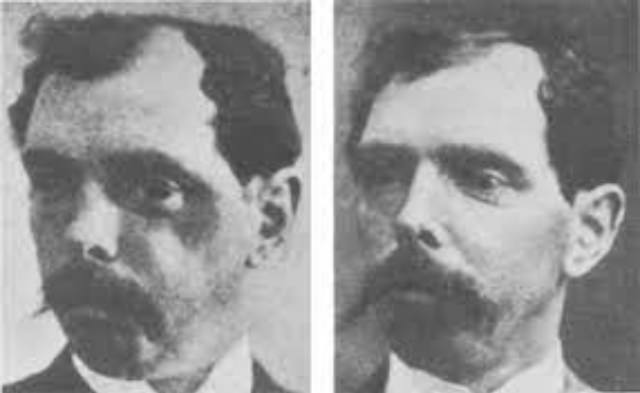 Nose Jobs Through the Ages: A Look at Rhinoplasty in the 1920s and 1930s