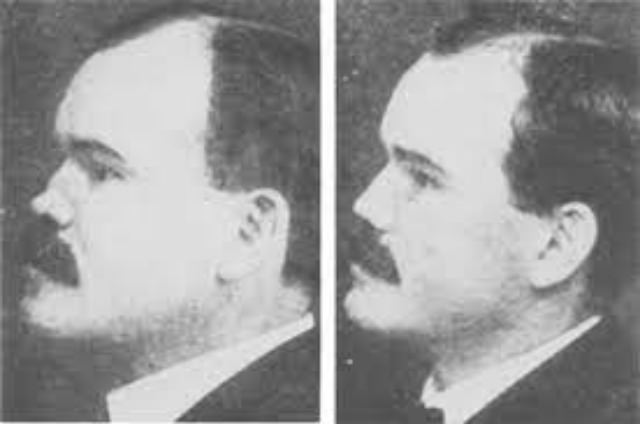 Nose Jobs Through the Ages: A Look at Rhinoplasty in the 1920s and 1930s