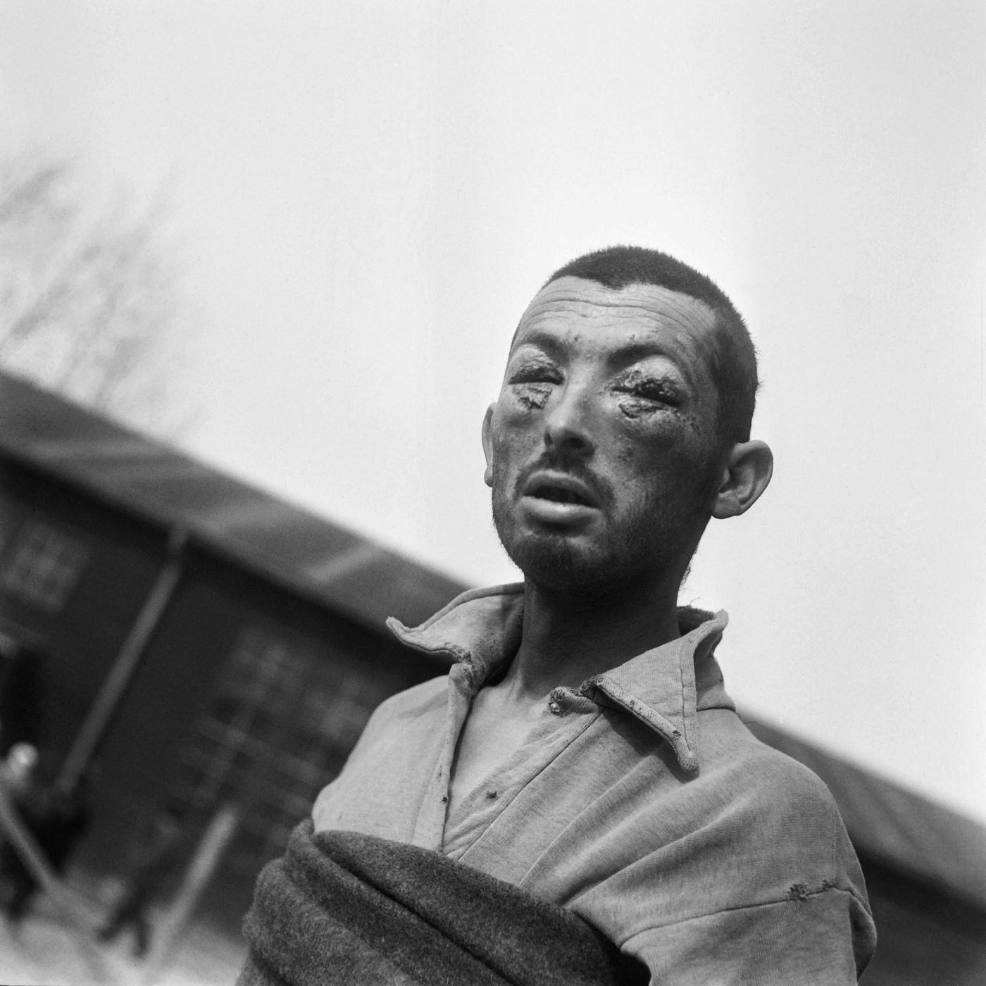 A tortured prisoner seen in Buchenwald concentration camp in April 1945.