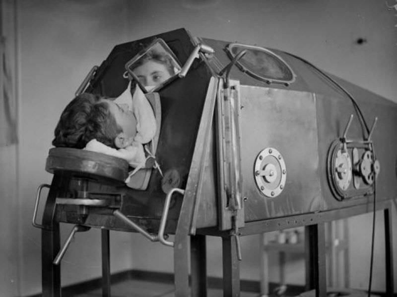 A patient lying in an artificial respiration machine called an iron lung, circa 1938.