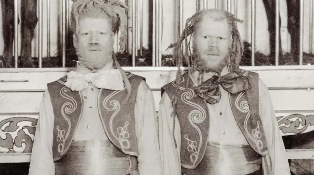 Tragedy to Stardom: The Harrowing Journey of the Kidnapped Muse Brothers