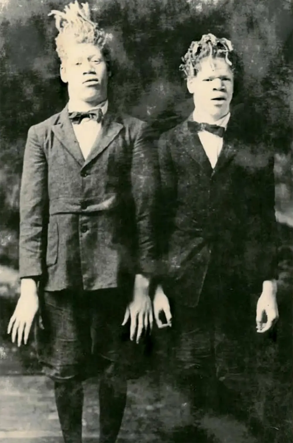 George and Willie Muse in the earliest known photograph of them in the circus.