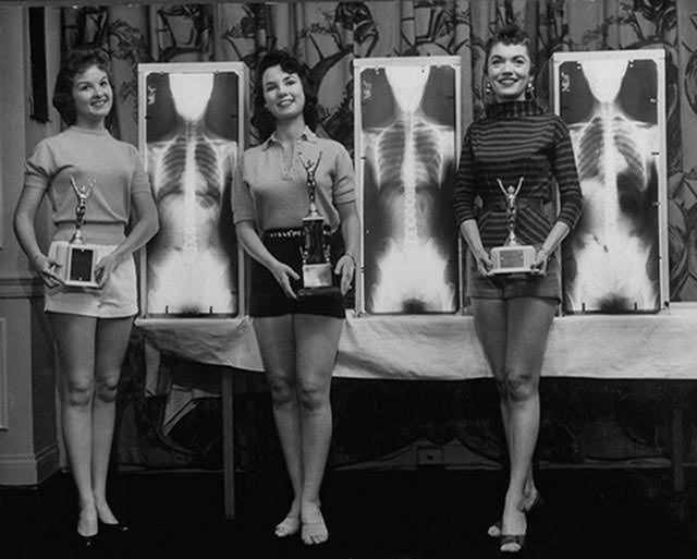 Miss Perfect Posture Winners at Chiropractor Convention, 1956