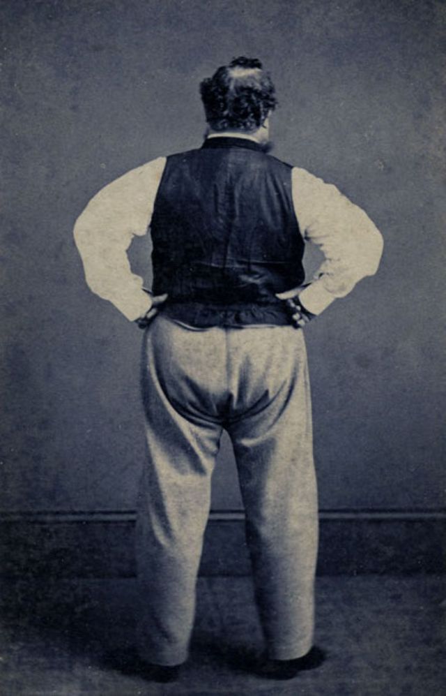 Back view of a balding man with hands placed on his hips