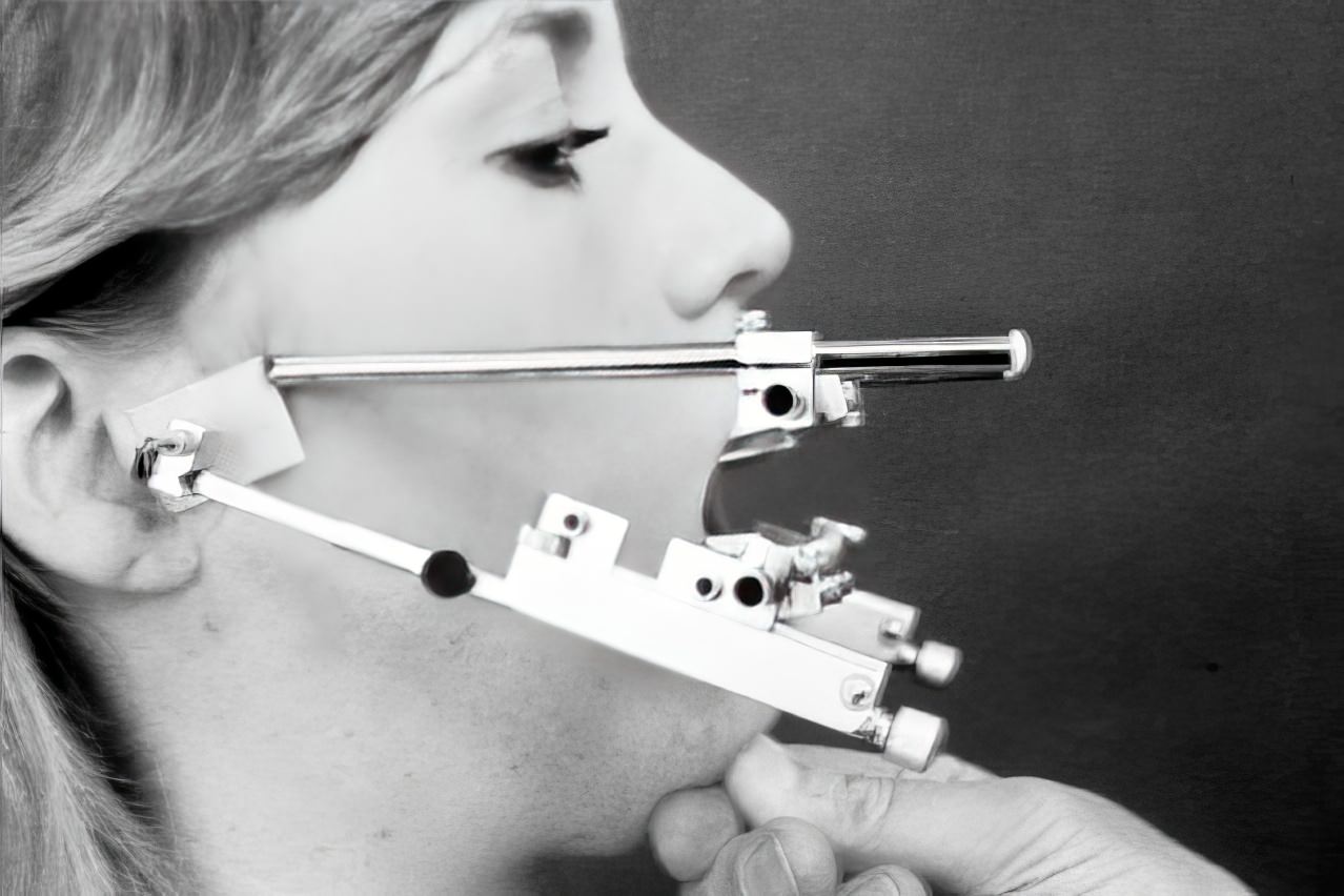 The Gnathograph: An Uncomfortable-Looking Device from the 1930s That Brought Precision to the Fit of Artificial Teeth