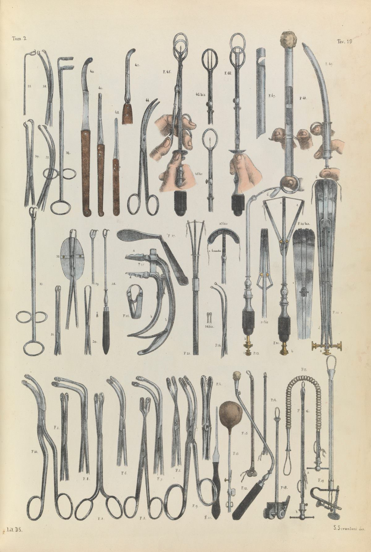 Tomo II, Tavola 19. Surgical instruments used on the tonsils and nasal cavity for the removal of polyps.