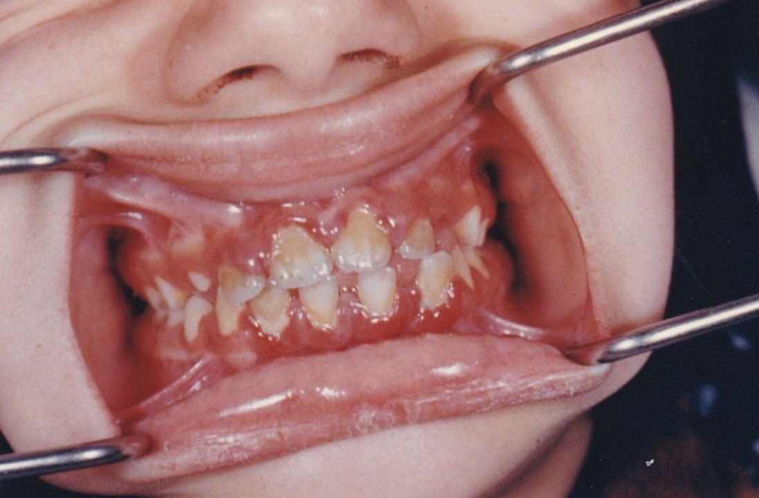 Brace Yourself for Laughter: Vintage Teeth Pics, That'll Make You Grin