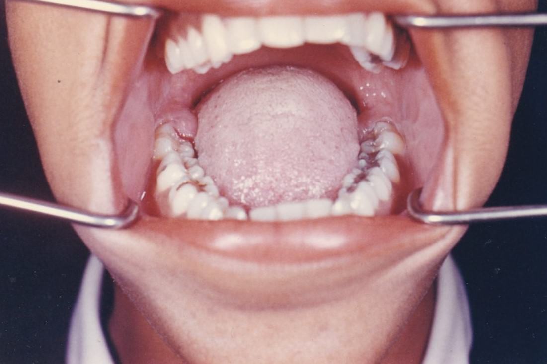 Brace Yourself for Laughter: Vintage Teeth Pics, That'll Make You Grin