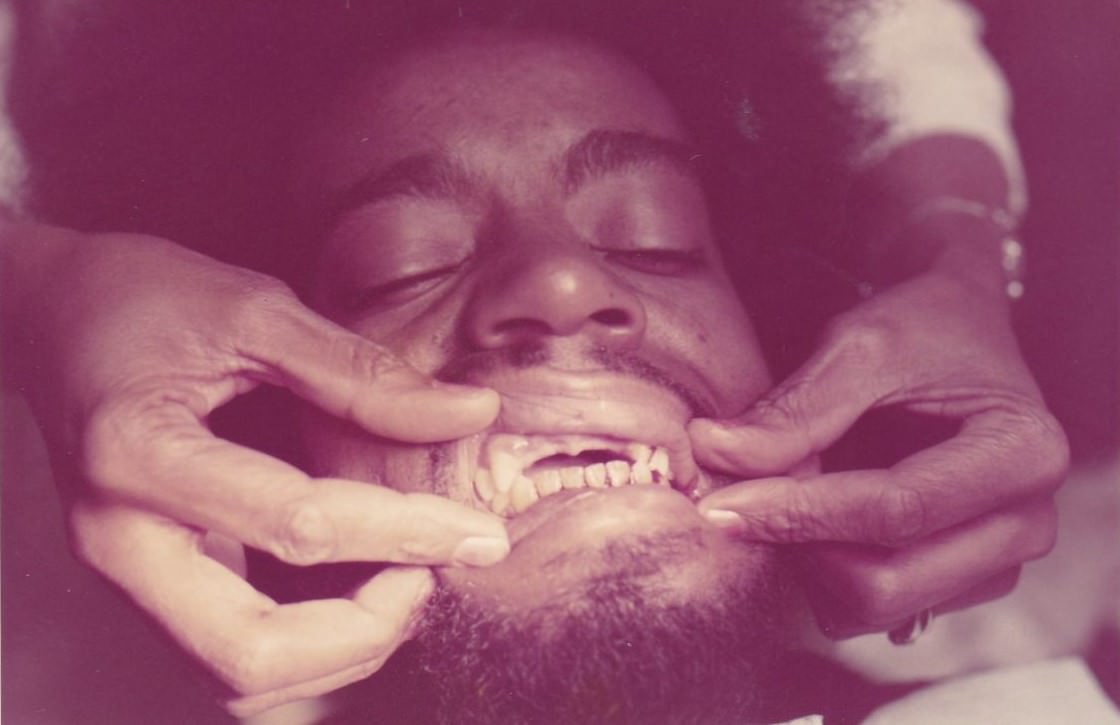 Brace Yourself for Laughter: Vintage Teeth Pics, That'll Make You Grin