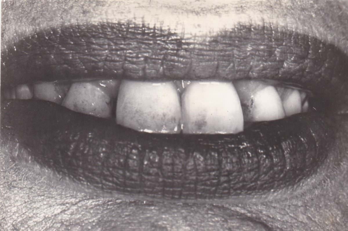 Brace Yourself for Laughter: Vintage Teeth Pics, That'll Make You Grin