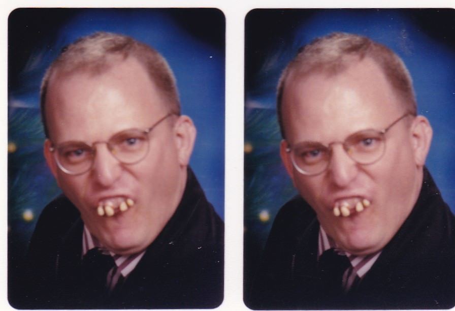 Brace Yourself for Laughter: Vintage Teeth Pics, That'll Make You Grin