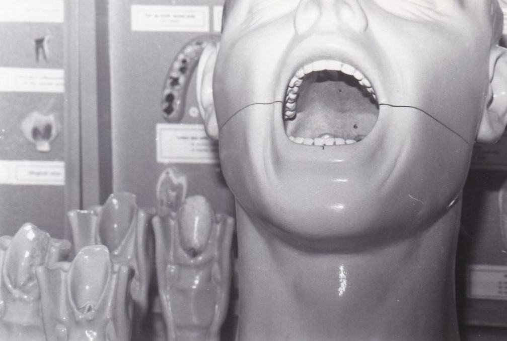 Brace Yourself for Laughter: Vintage Teeth Pics, That'll Make You Grin