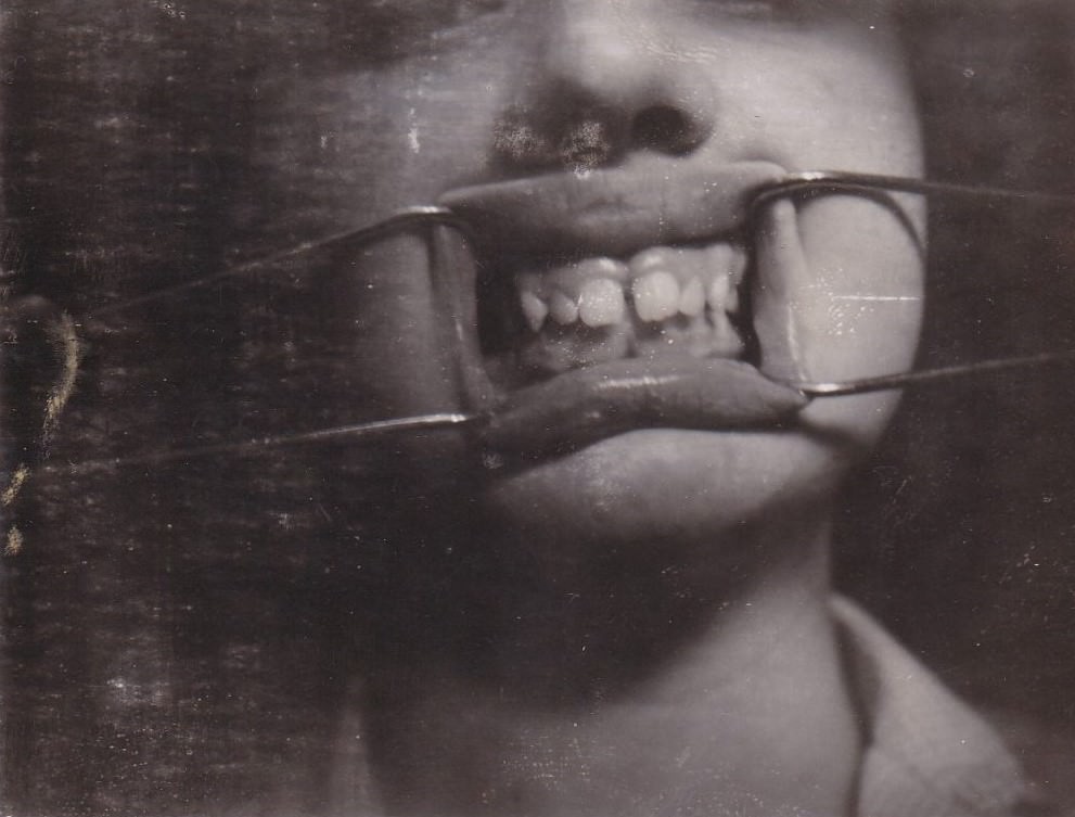 Brace Yourself for Laughter: Vintage Teeth Pics, That'll Make You Grin