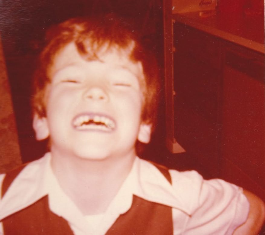 Brace Yourself for Laughter: Vintage Teeth Pics, That'll Make You Grin