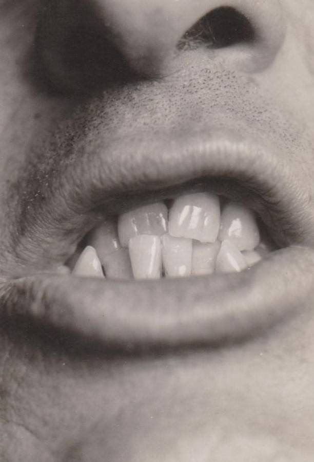 Brace Yourself for Laughter: Vintage Teeth Pics, That'll Make You Grin