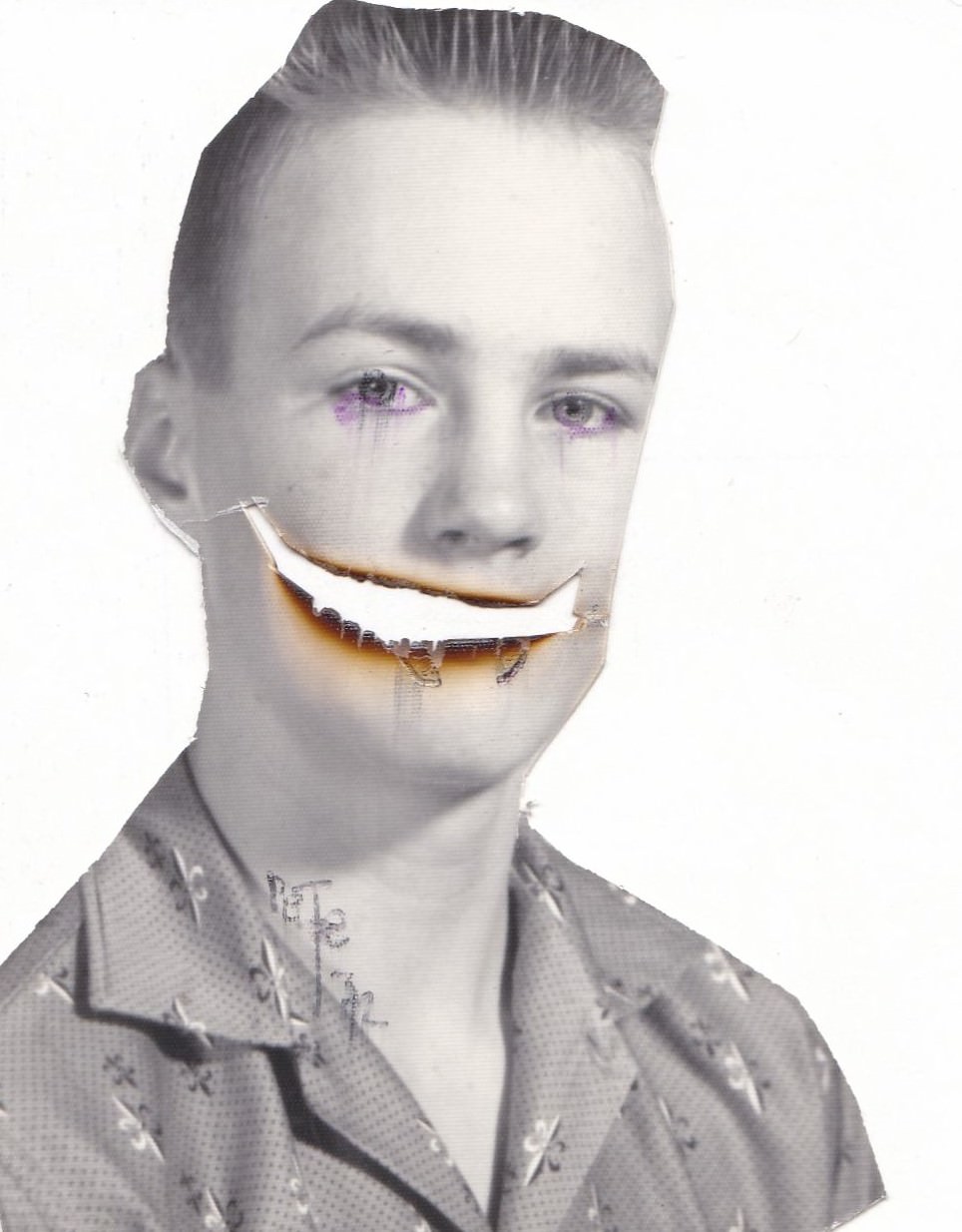 Brace Yourself for Laughter: Vintage Teeth Pics, That'll Make You Grin