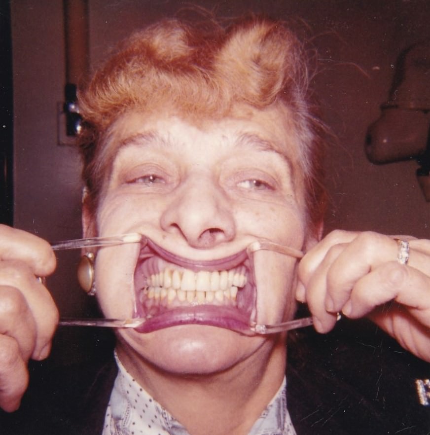 Brace Yourself for Laughter: Vintage Teeth Pics, That'll Make You Grin