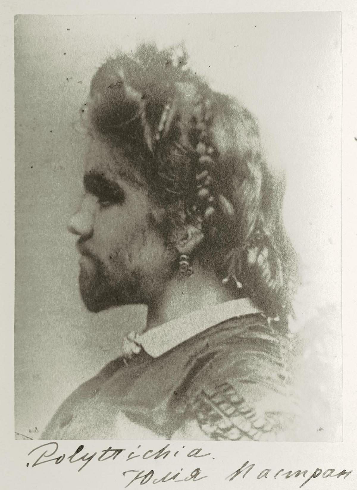 “The Bearded Lady” Julia Pastrana (1834–60), who toured Europe and North America in the 1850s (upper left). Pastrana died in childbirth while in Moscow in 1860.