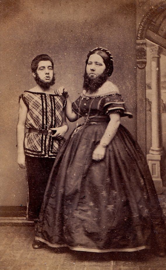 Wait, What?! Hilariously Bizarre Vintage Photos That Can't Be Explained