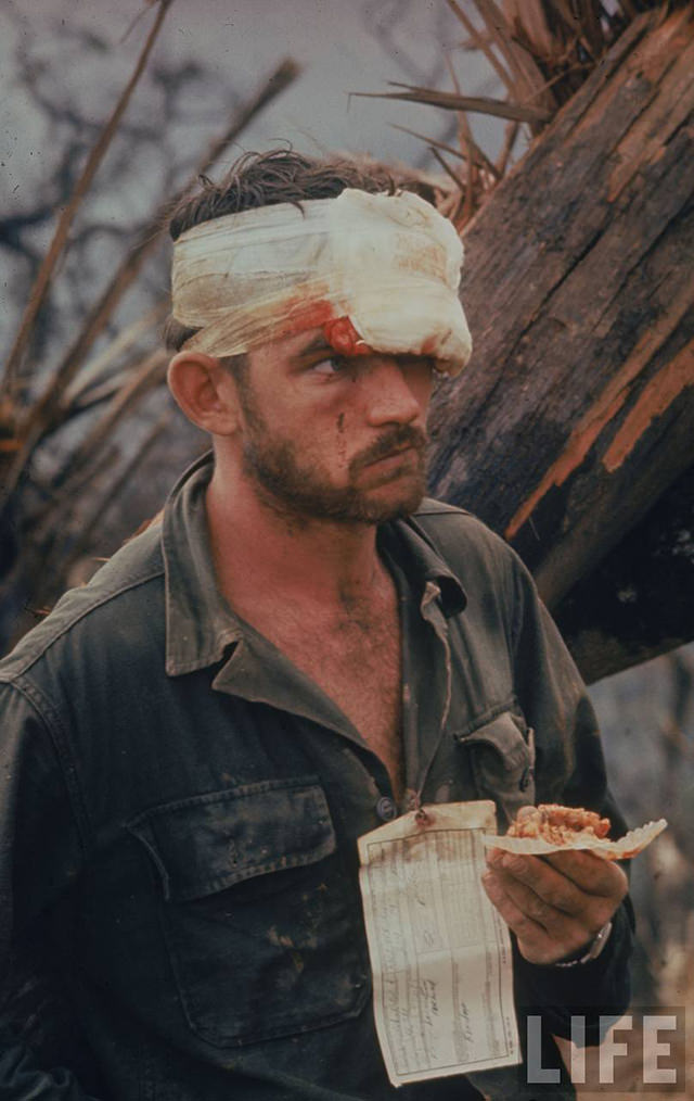 American soldier w. a bandaged head wound looking dazed after participating in Operation Prairie just south of the DMZ.