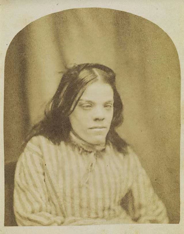 Maps of the Mind: A Haunting Look at the 1855 Portraits of Patients of Surrey County Asylum