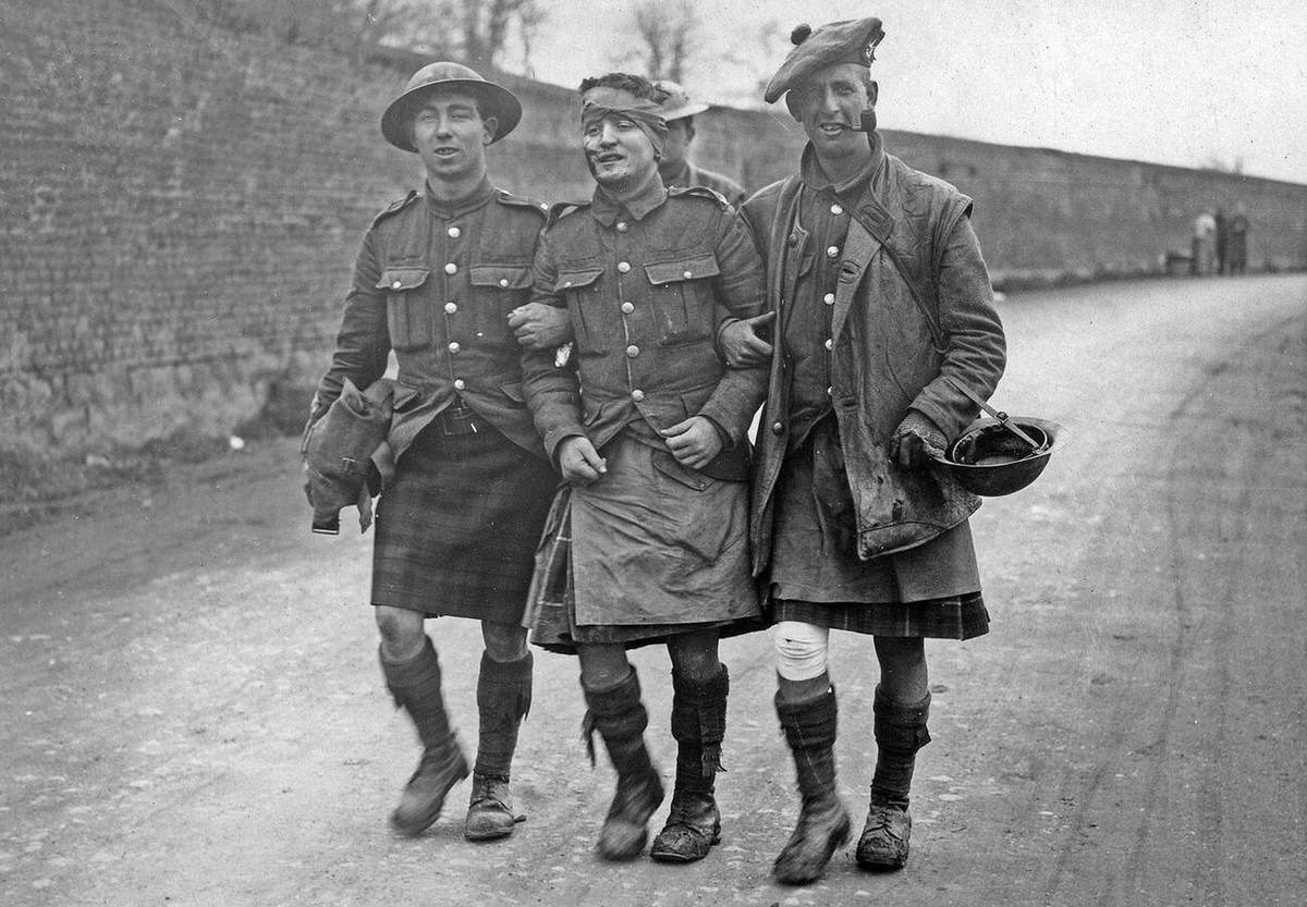Walking wounded of the 51st Division on the British Western Front, 1914