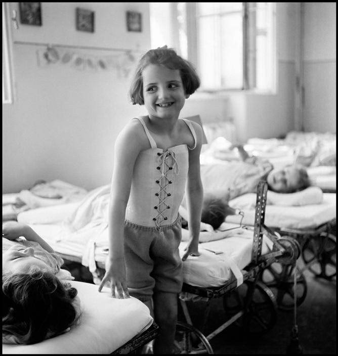 Girl suffering from spinal tuberculosis at Bellevue Hospital in Vienna, 1948