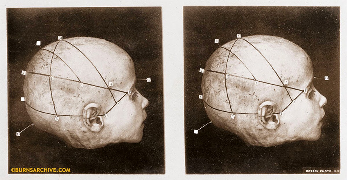 Cranio-cerebral Topographical Study of A Child’s Head, 1916.